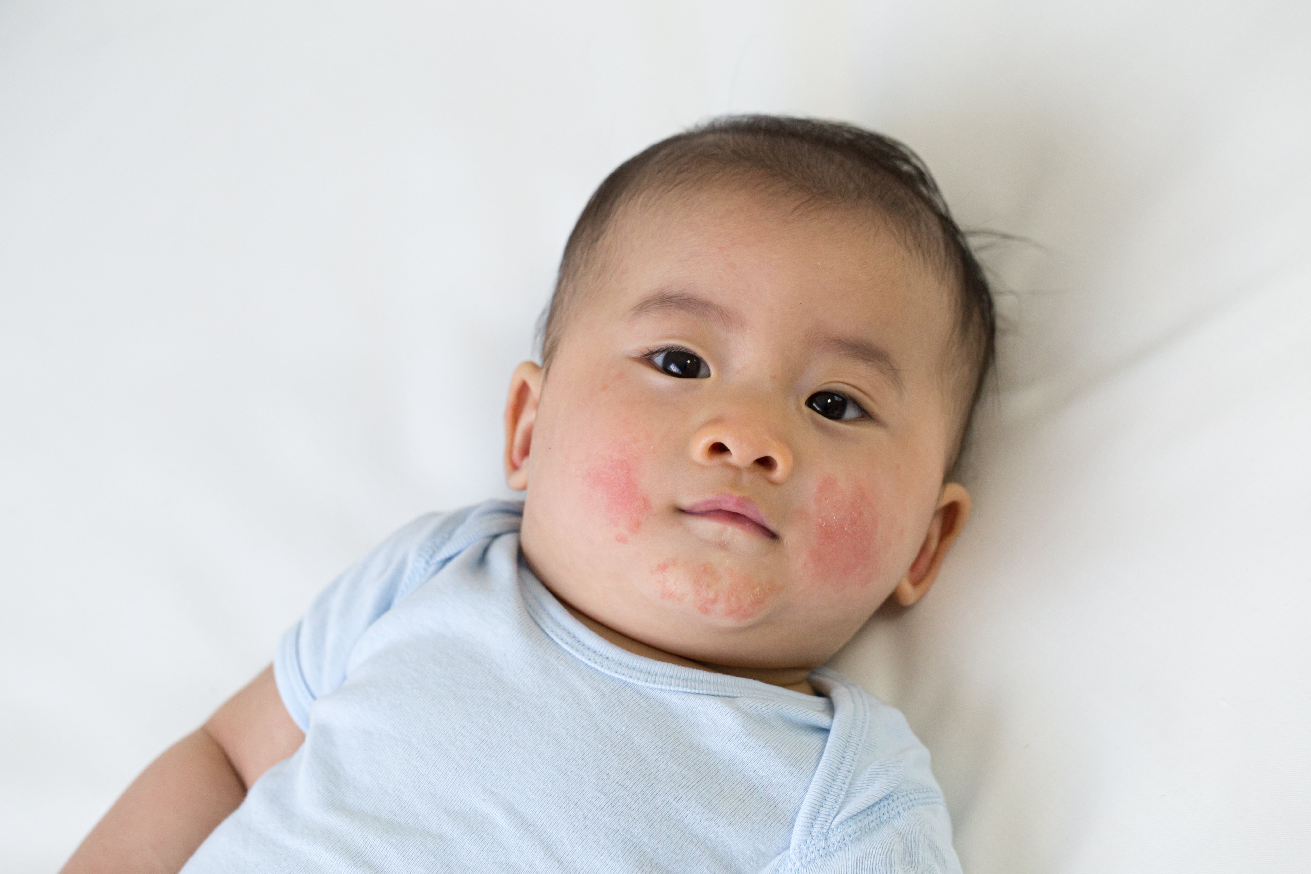 Why Does My Baby's Face Get So Red? - Understanding Facial Irritation in Infants