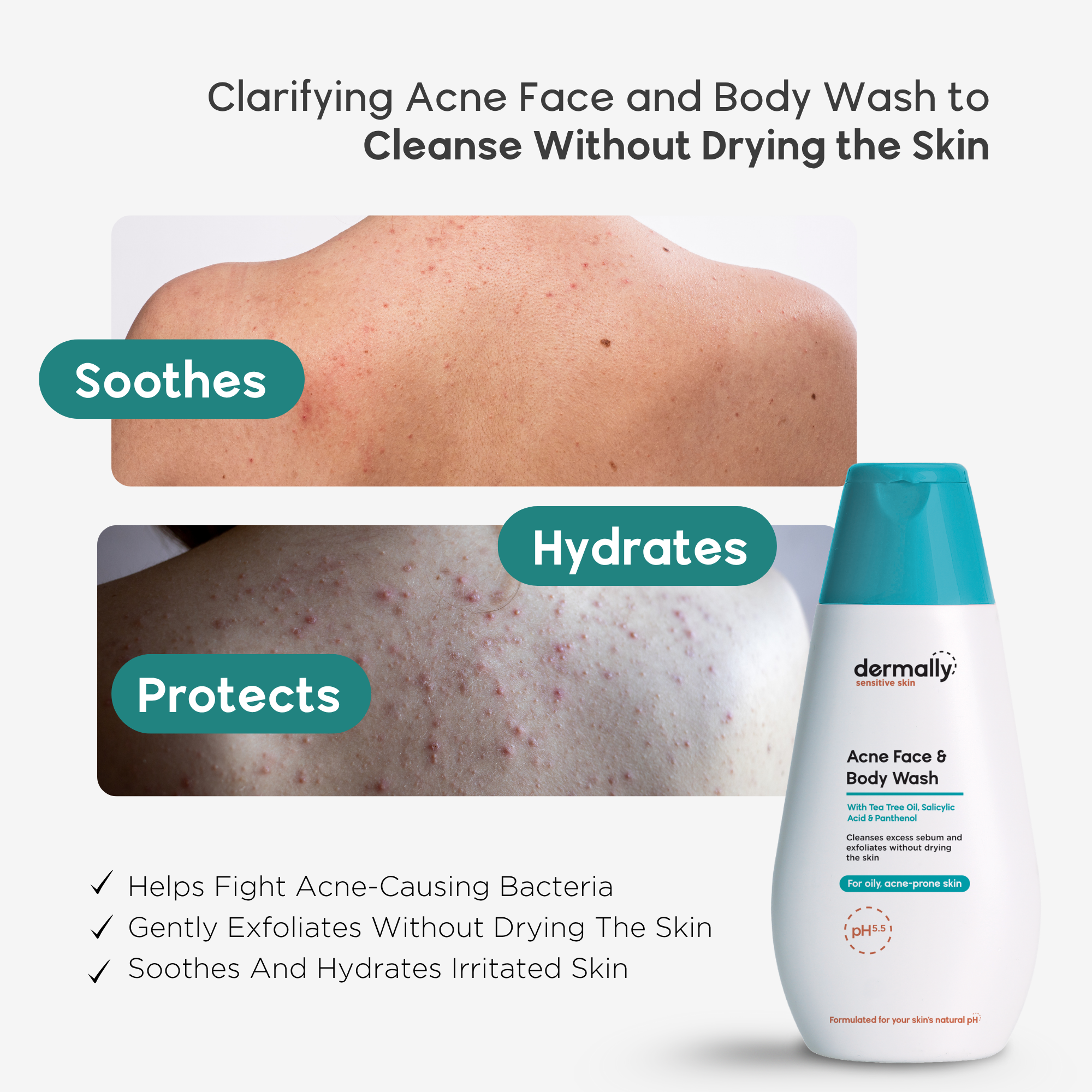 Acne Face & Body Wash